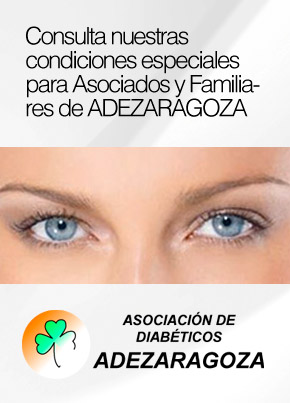 acuerdo yanguas adezaragoza
