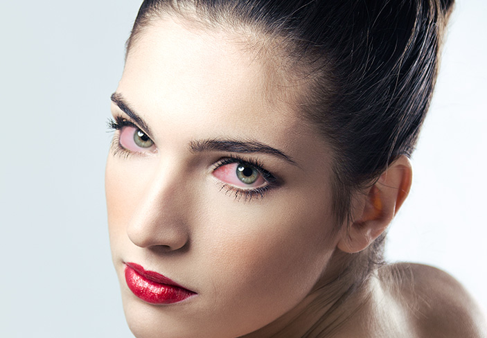Alergia Ojos Rojos