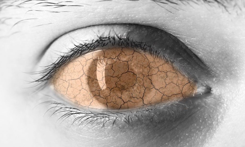 Ojos secos Zaragoza
